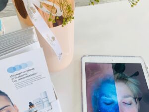SKIN DIAGNOSIS
